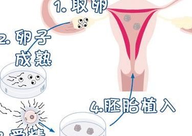 2026年国内十大试管婴儿医院排名 国内试管婴儿医院排名