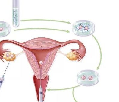 宫腔镜检测出cd38阳性可以正常做第三代试管婴儿吗？